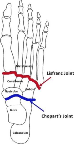 Les articulations de Lisfranc et de Chopart : de la chirurgie de guerre à la biomécanique du pied